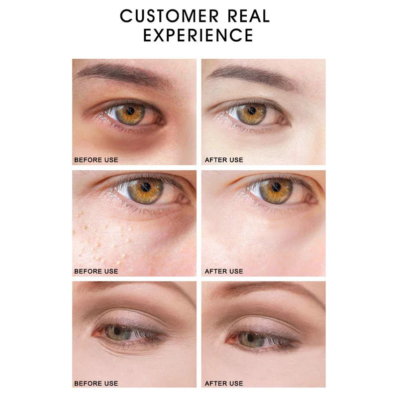 Combo de Crema y Sérum Contorno de Ojos Artiscare