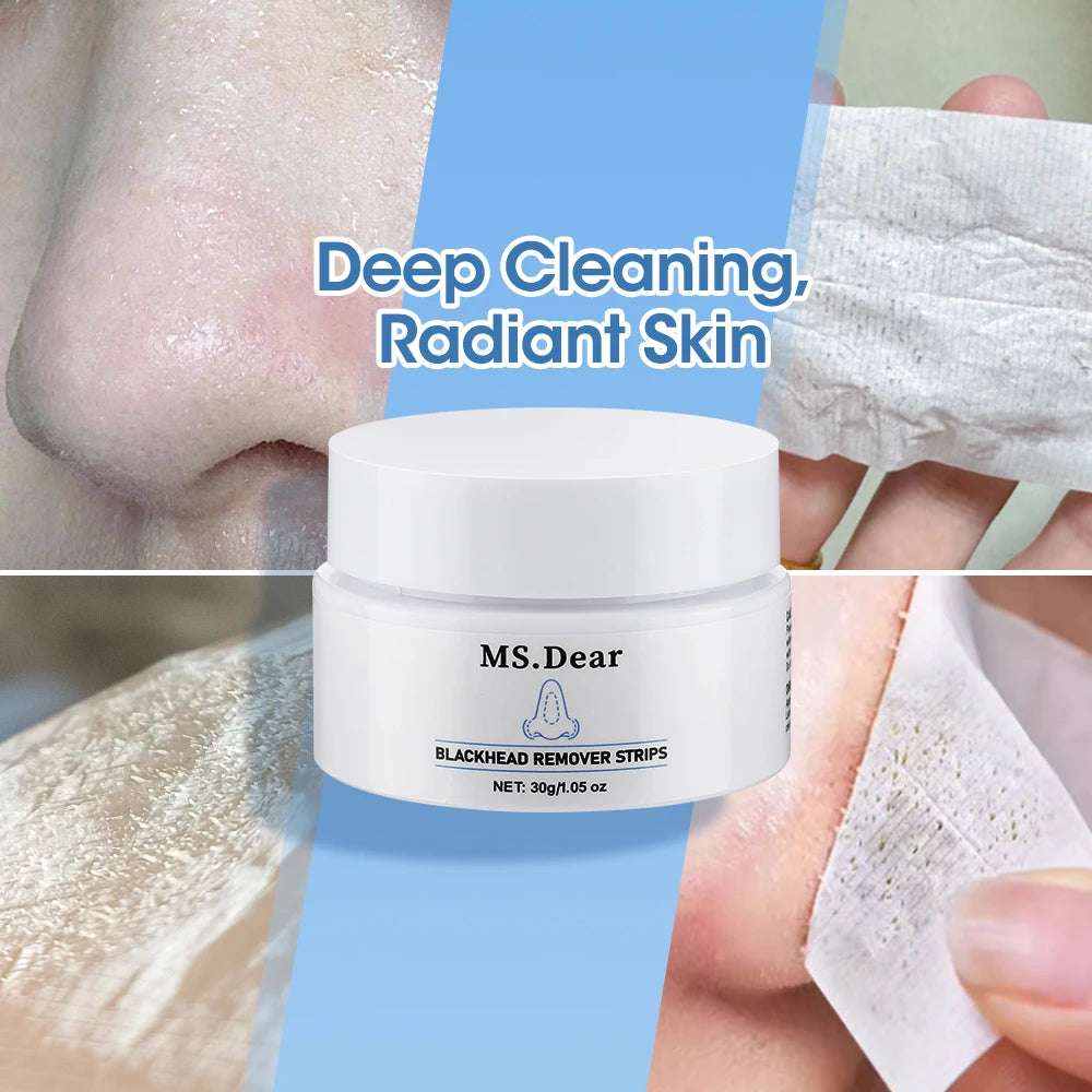 Crema+tiras para eliminar puntos negros.
