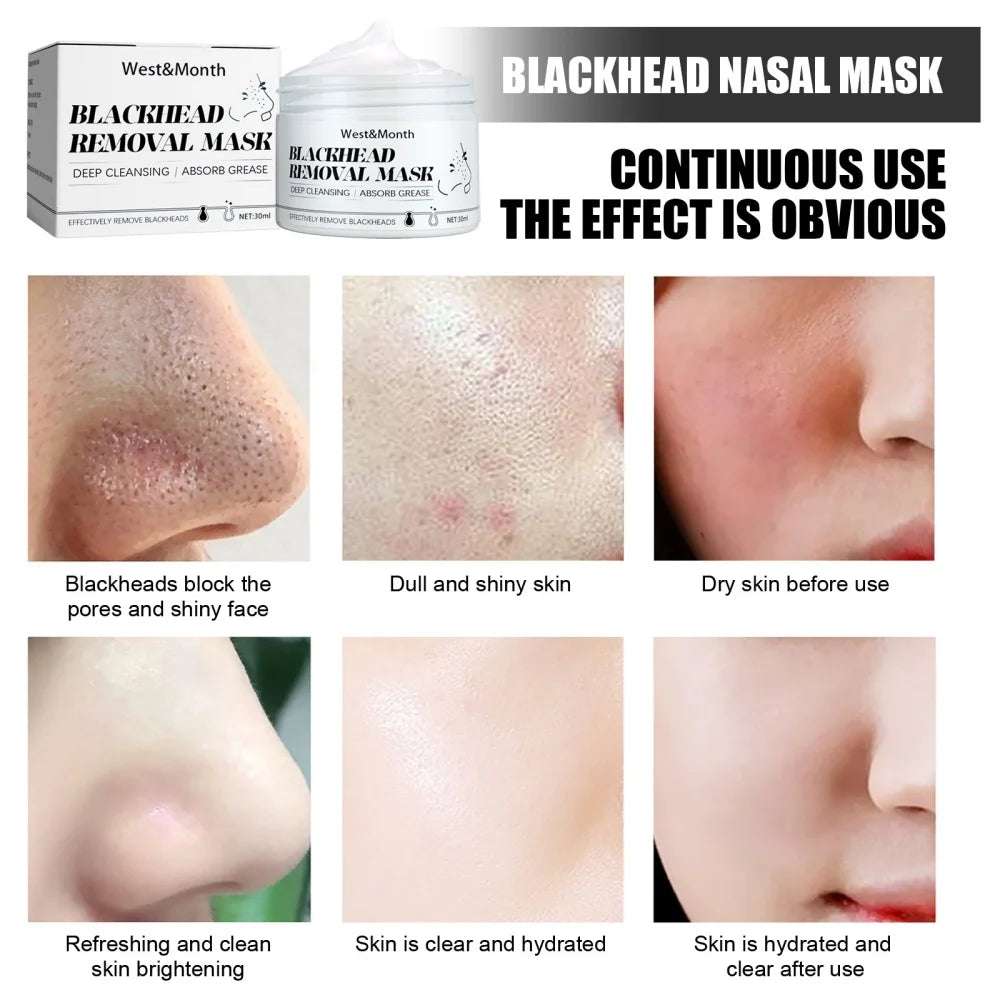 Mascarilla para quitar puntos negros.