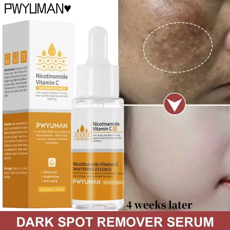 Sérum Facial Blanqueador de Niacinamida y Vitamina C