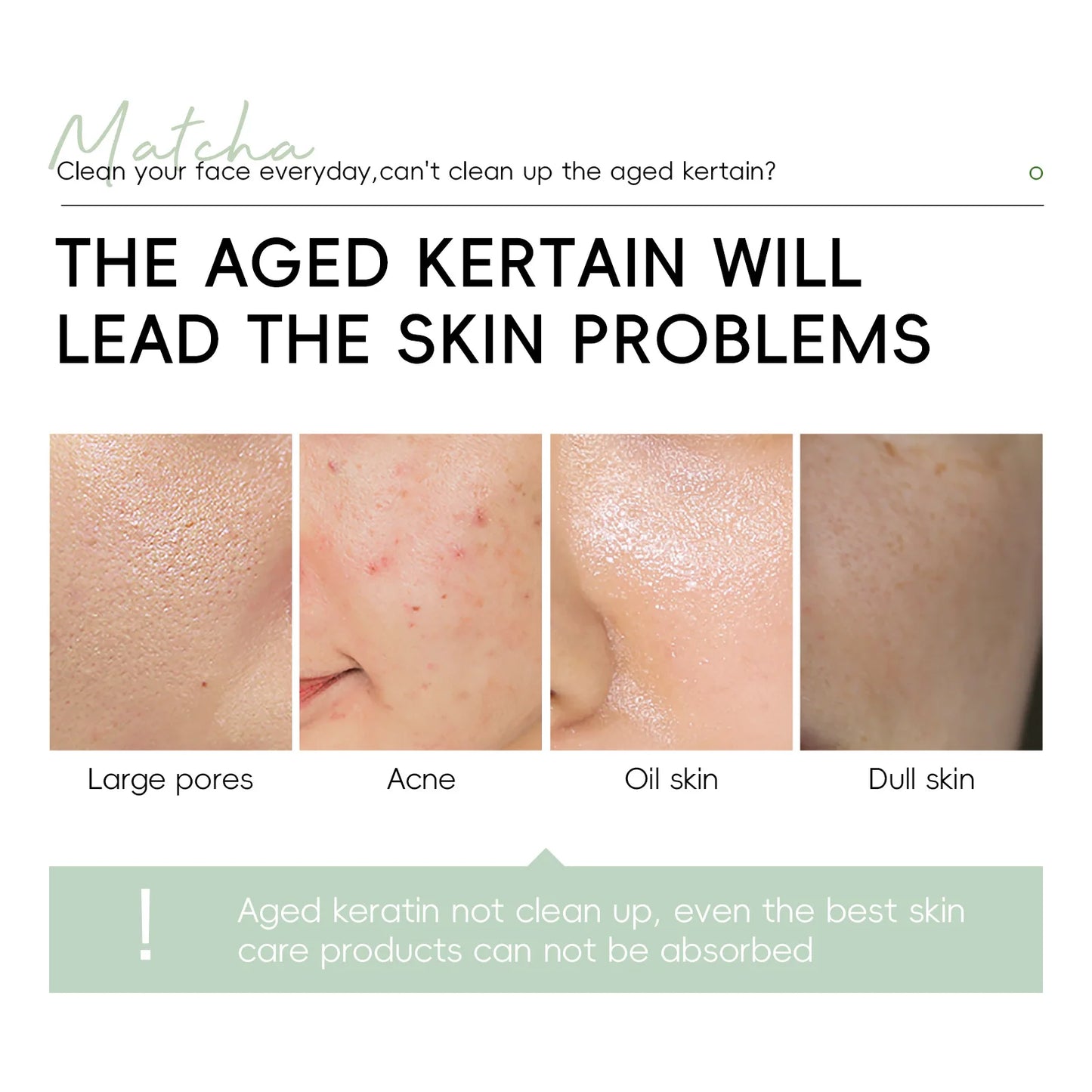 Gel Exfoliante Facial Laikou