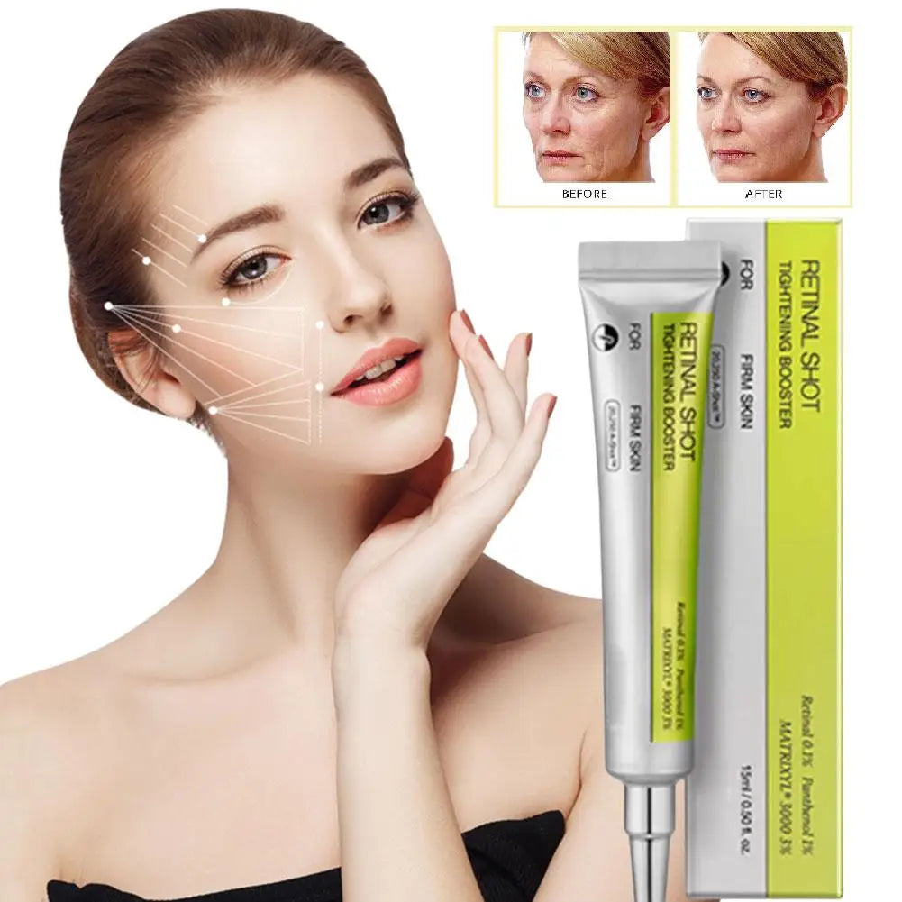 Set de tratamiento facial, reforzamiento para la piel con retinol ESSENCE