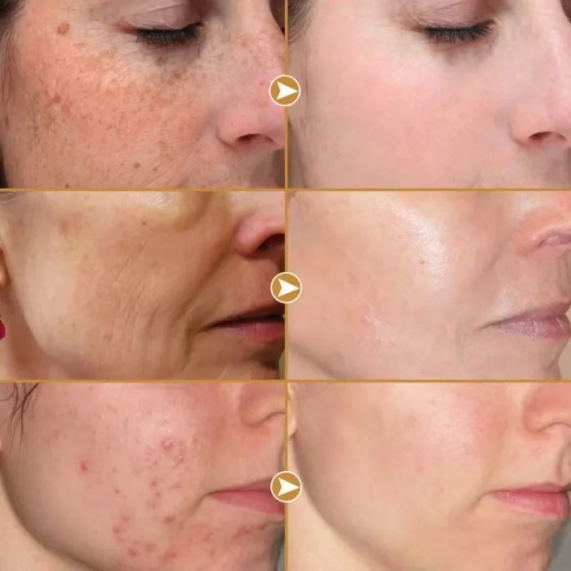 Sérum Facial Blanqueador de Niacinamida y Vitamina C
