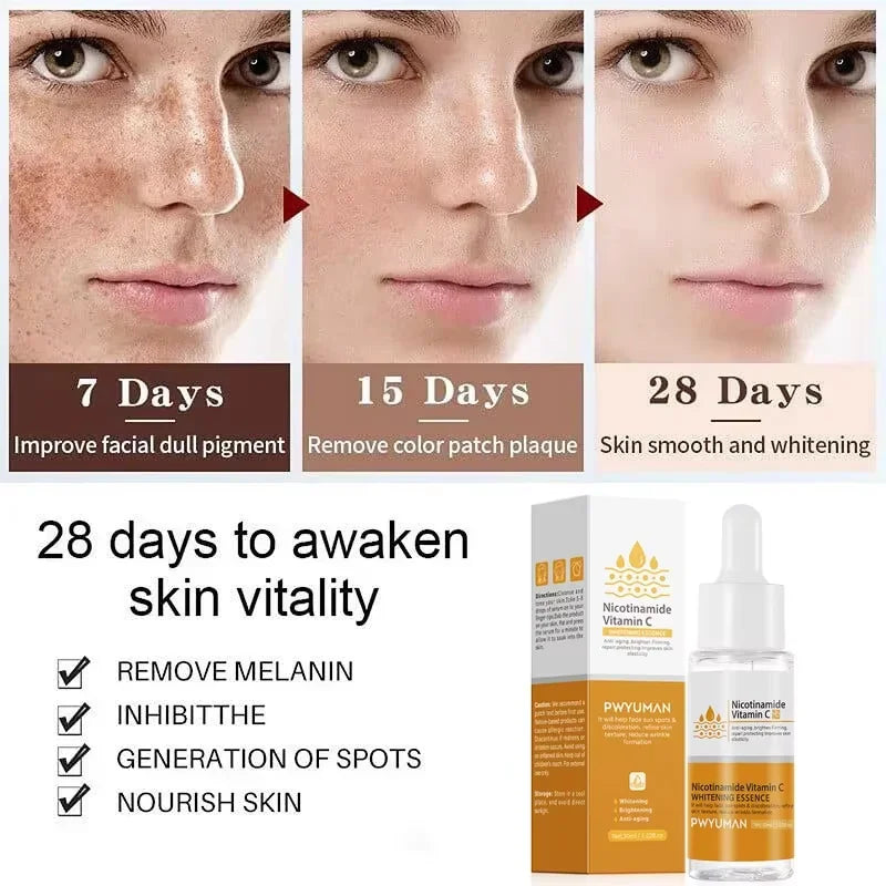 Sérum Facial Blanqueador de Niacinamida y Vitamina C