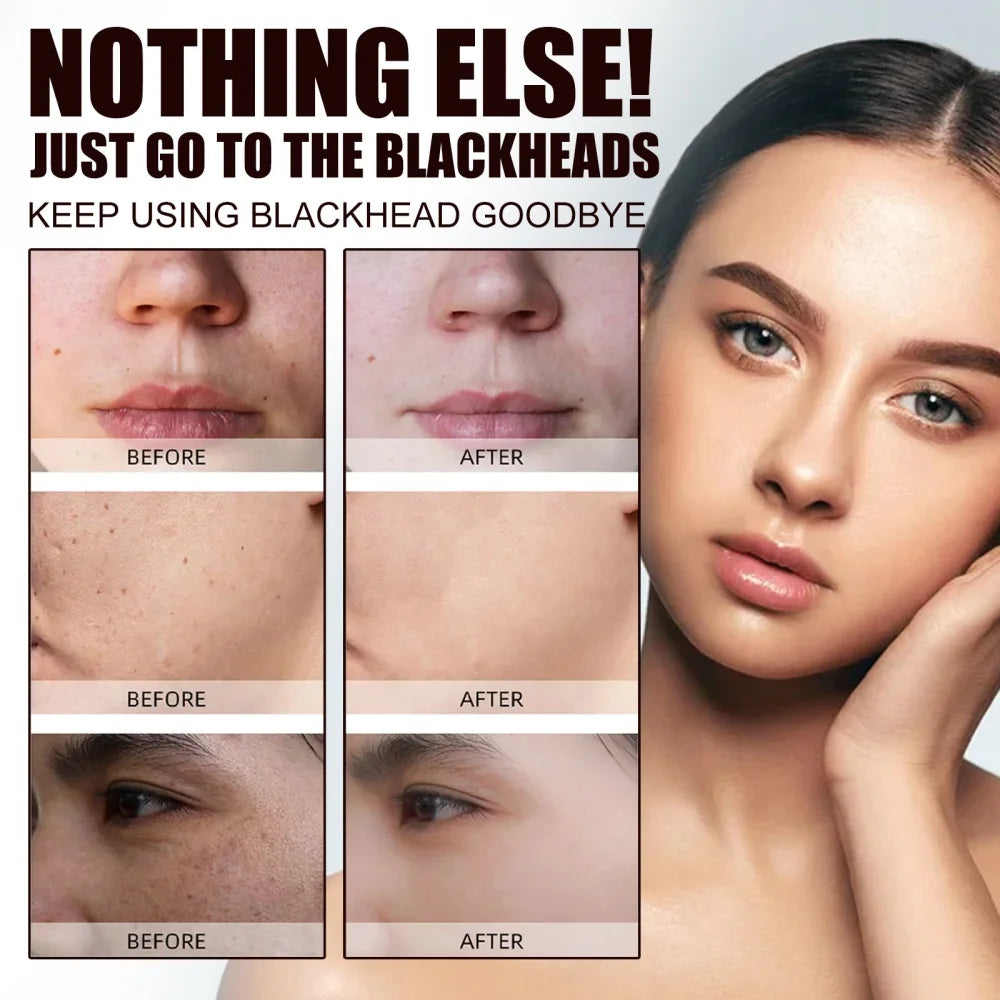 Mascarilla para eliminar los puntos negros West and Month