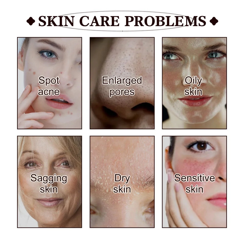 Mascarilla para eliminar los puntos negros West and Month