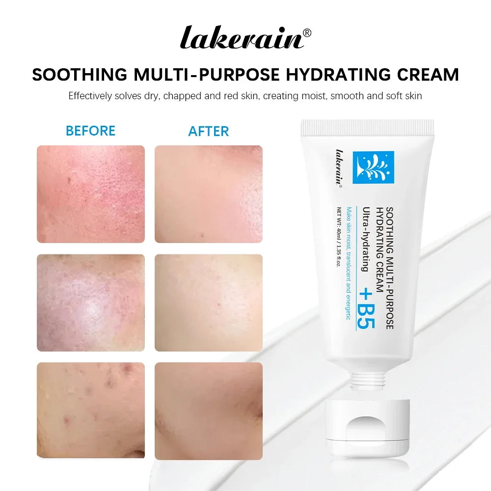 Crema para eliminar manchas del rostro lakerain