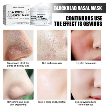 Mascarilla para quitar puntos negros.