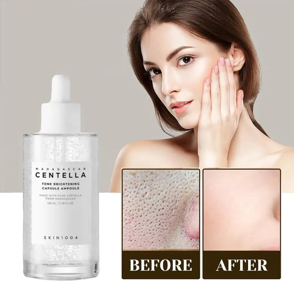 Esencia de centella asiática SKIN1004,