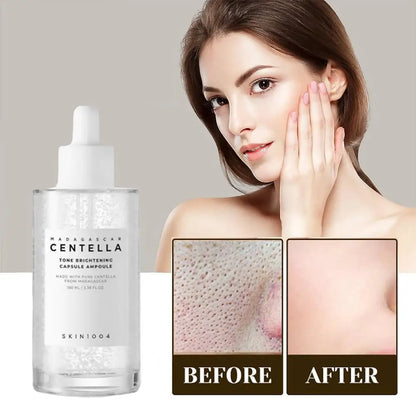 Esencia de centella asiática SKIN1004,