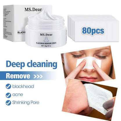 Crema+tiras para eliminar puntos negros.