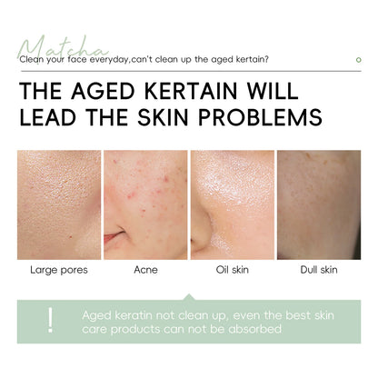 Gel Exfoliante Facial Laikou