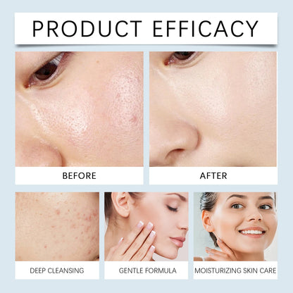 Aceite limpiador de maquillaje y facial Hoygi