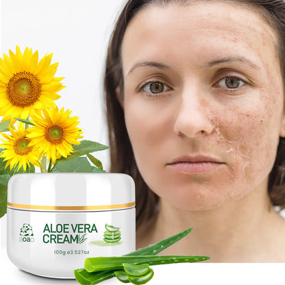 Crema de aloe vera AOAO