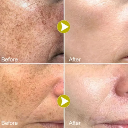 Sérum Facial Blanqueador de Niacinamida y Vitamina C
