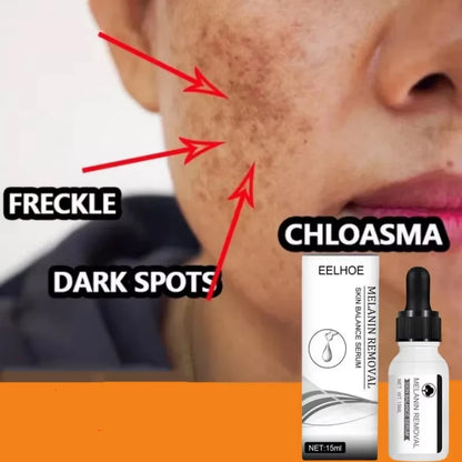Skin balancing serum.