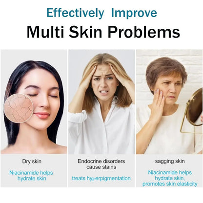 Serum facial TRSTAY