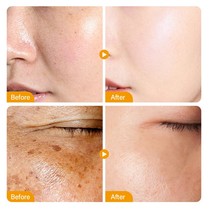 Sérum Facial Blanqueador de Niacinamida y Vitamina C